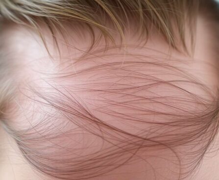 Comprendre les couches du cuir chevelu : guide complet